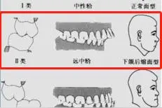 小姑娘突然疼痛难忍、张不开口，医生说：这得治图片