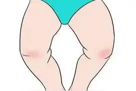 维生素D该如何给宝宝补？图片