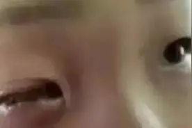 短短20分钟，8岁男孩整个眼球被溶解！赶快告诫孩子远离它图片