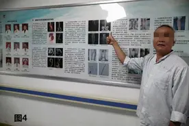 抽烟30年脚趾坏死险截肢！老烟民当心这些病兆图片