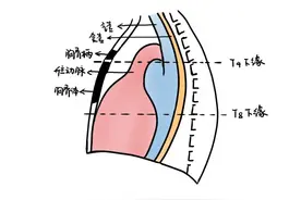 「一干三弓三毛」是什么-胸部CT纵隔窗正常解剖结构 | 协和八图片