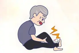 艾灸后，绍兴大爷差点截肢 专家：5个老年人里就有一个中招图片