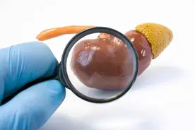 尿毒症进入晚期前，身体会有9个异常表现，留意到一个，也要重视图片