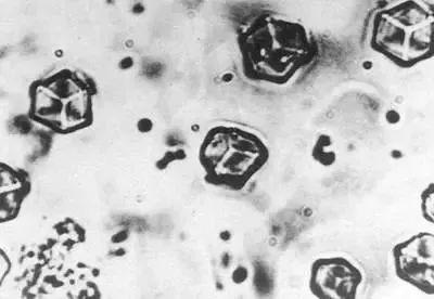 百年瞬间丨我国完成人工全合成结晶牛胰岛素