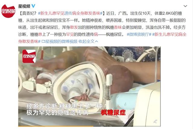 现实版“香妃”？新生儿全身散发甜甜的香味，洗也洗不掉！竟然是一种病