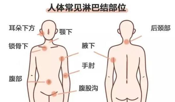 身上好多淋巴结怎么办