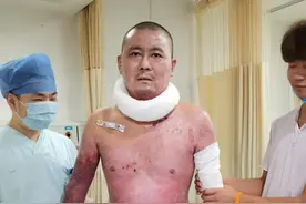 杭州电瓶车爆燃烧伤父女最新情况：父亲出院，女儿仍在抗感染图片