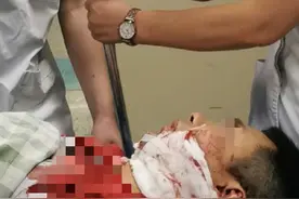 福州2名眼科医生中秋值班被患者持刀刺伤，警方已立案侦查图片