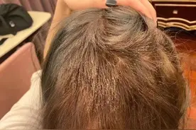 记者帮｜染发后头发刷刷断，丑得出不了门；美发店被索赔20万，店长很委屈。这事你站谁？图片