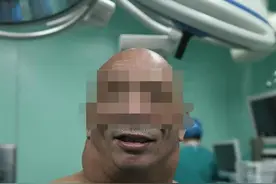 吓人！湖北一男子日饮白酒三两斤，脖子粗得像河马图片