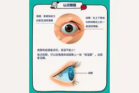 一觉醒来眼睛特别干，看东西也有些模糊，是怎么回事？图片