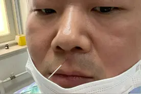 岳云鹏扎针灸晒照 画面搞笑却被医生嘱咐不许笑图片