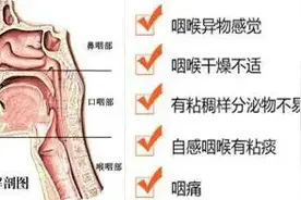咽口水都痛，晚上睡不好…咽喉痛，不容忽视图片