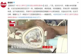 现实版“香妃”？新生儿全身散发甜甜的香味，洗也洗不掉！竟然是一种病……图片