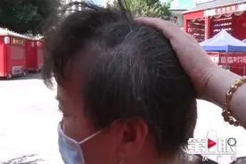 专家：目前还没有明确有效方法让白发变黑图片