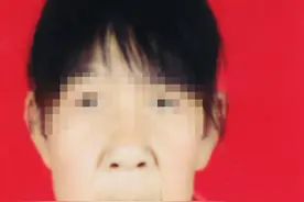 罕见病少女来上海就医！14岁竟“面容似老人”，跑了好多医院都说没办法图片