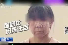 14岁少女“面容似老人”  将历经多期整形手术视频封面