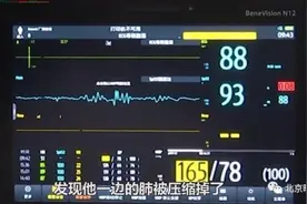 男子含话梅睡觉梅核卡气道险丧命！这一招，请牢记图片