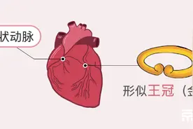 3亿人的血管为什么都“堵”了？10张图让你秒懂图片