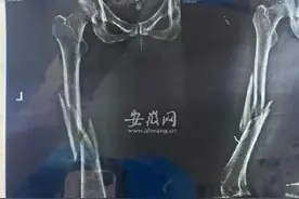 女子第一次上瑜伽私教课被老师压断大腿图片