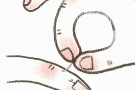 倒刺能不能撕？有人撕倒刺把自己送进了医院图片