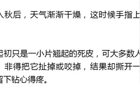 疼疼疼，倒刺撕到停不下来！真不是缺维生素，而是因为这个习惯…图片