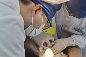 为了小小的舌系带，他们跑了800公里来到杭州，舌系带的问题今天一并科普图片