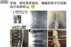 短短一个半月，车祸瘫痪男孩重新站起来，能走路了图片
