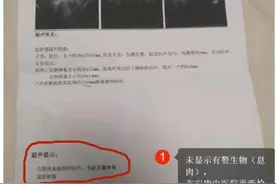 女生无病被推上手术台 涉事医院曾涉重大医疗事故：致患者十级伤残图片