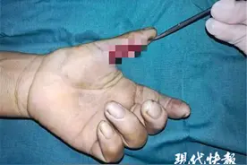 国庆假期，邳州20余人被“栽蒜机”绞伤图片