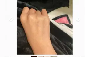 两网友自称在广州街头被人扎针怎么回事？事件详细始末来龙去脉曝光图片