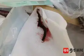 睡梦中，长约5cm的蜈蚣钻进女士耳朵里，还乱窜图片