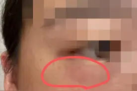 一条虫子竟然上了热搜！网友：再也不敢关灯玩手机了图片