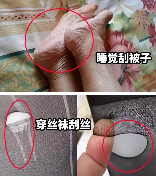 身体乳可以擦脚足部吗