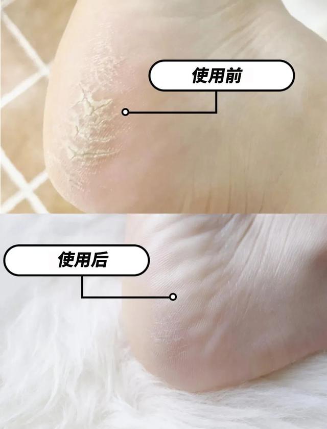 身体乳可以擦脚足部吗