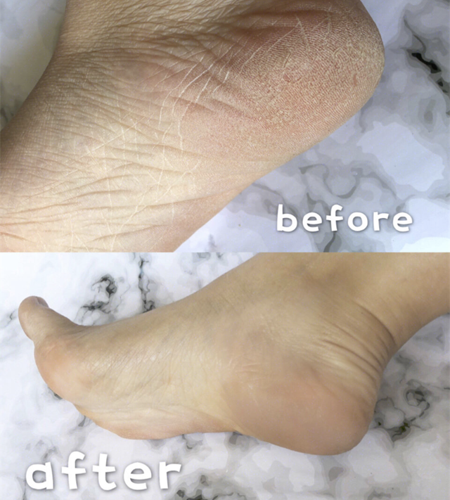 身体乳可以擦脚足部吗