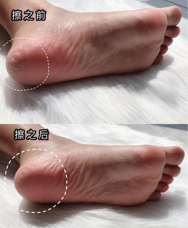 身体乳可以擦脚足部吗