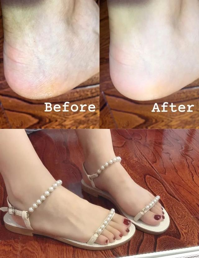 身体乳可以擦脚足部吗