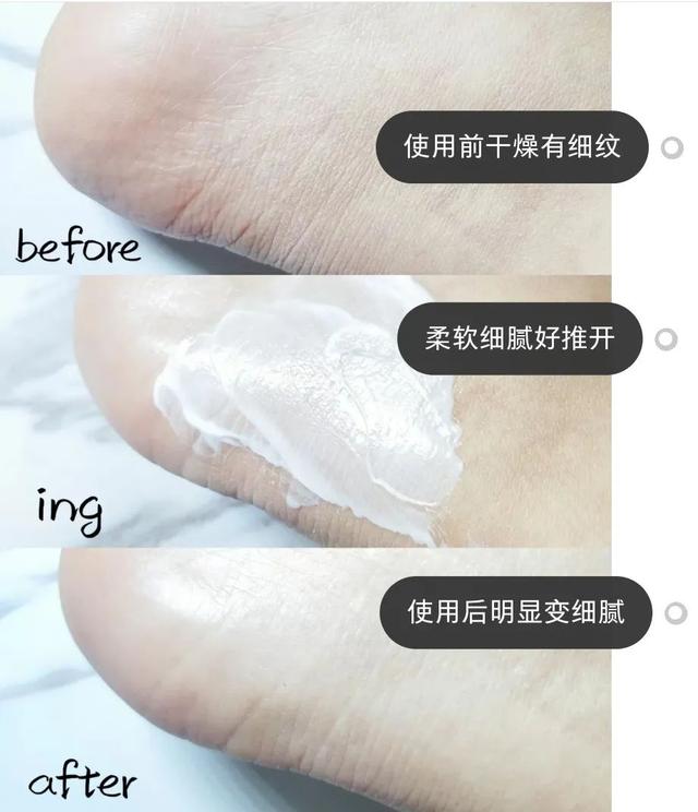 身体乳可以擦脚足部吗