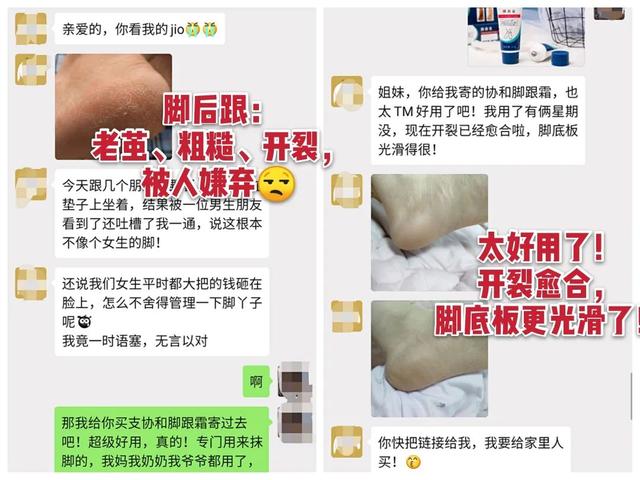 身体乳可以擦脚足部吗