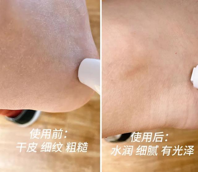 身体乳可以擦脚足部吗