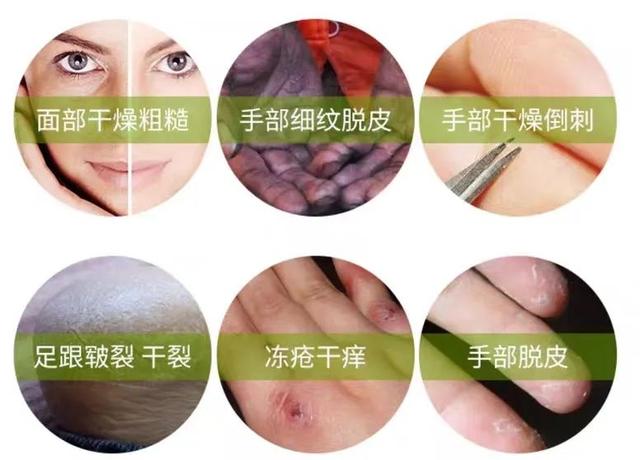 身体乳可以擦脚足部吗