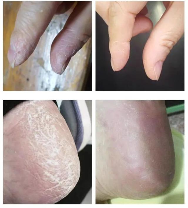 身体乳可以擦脚足部吗