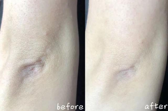 身体乳可以擦脚足部吗