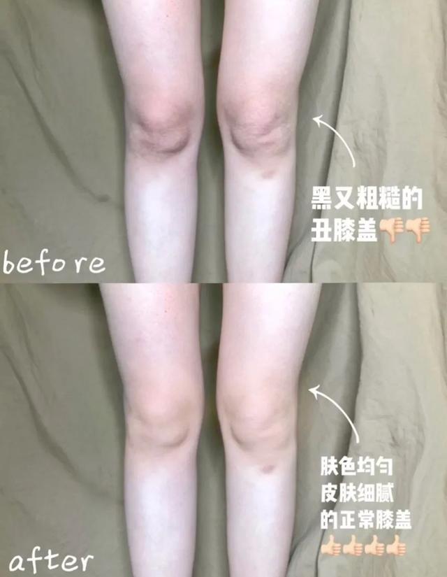 身体乳可以擦脚足部吗