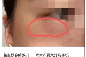 又是它！女子半夜关灯玩手机，险些致毁容……图片