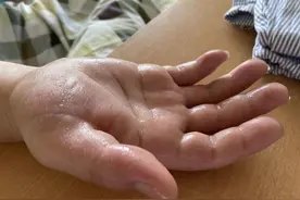 不敢和人交流，工作也丢了！28岁小伙连连叹气：这病太折磨图片