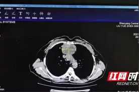 邵阳市中心医院完成又一例高难度剑突下胸腔镜纵膈肿瘤切除术图片