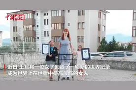 世界上在世者中最高的女人：身高2.15米，行走需要支架图片