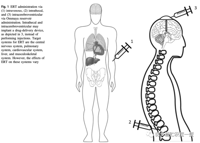 黏多糖贮积症的酶替代疗法：过去、现在和将来